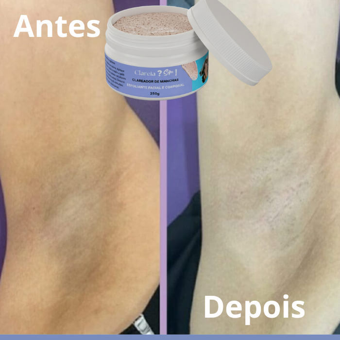 como ter axilas claras
